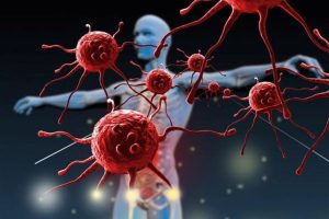 Early cancer signs showing abnormal cancer cell growth in the human body
